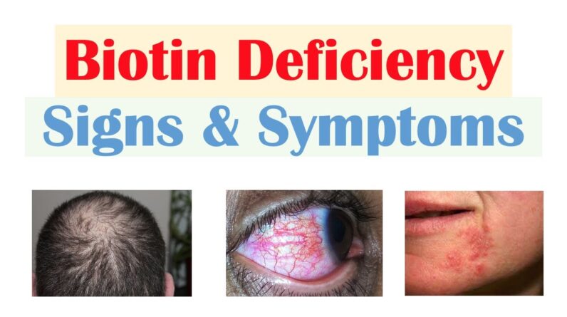 Biotin (Vit B7) Deficiency Signs & Symptoms (& Why They Occur)